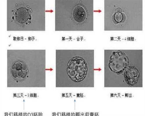 查不孕