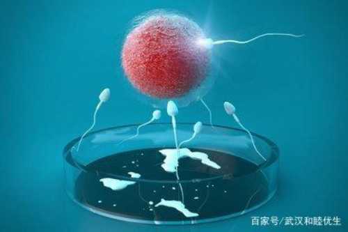 多囊卵巢综合征不孕