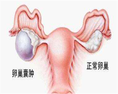 高泌乳素血症试管